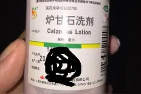 常见的皮肤止痒外用药图片
