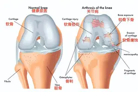 膝盖疼得下不了楼？教你几招，90 岁还健步如飞！图片
