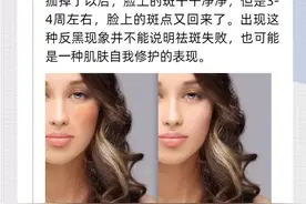 祛斑后反黑？只怕是你用错了方法图片