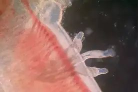 不要什么都吃，一口下去若干个寄生虫图片