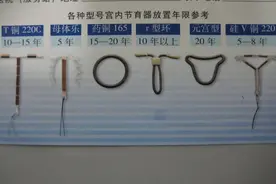 中国第一批“上环”的女性，医生揭露：30年了，难逃出这5种结局图片