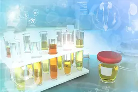 这两味中药可降低蛋白尿图片