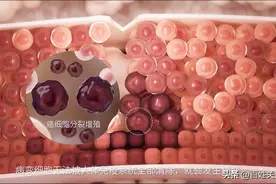 你真的了解HPV疫苗吗？国产二价同样值得！图片