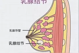 #健康中国行动2030# “乳腺结节就是癌？”且听医生怎么说图片