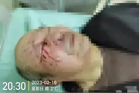 73岁退伍老兵被养老院打爆眼球，院方：我们用的是日本管理理念图片