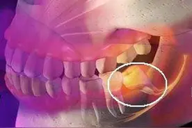 不同牙痛，用药不同！建议收藏转发图片