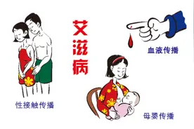 ​关于艾滋病，这些你必须了解！图片