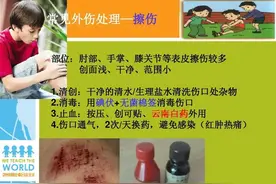 外伤的健康宣教图片
