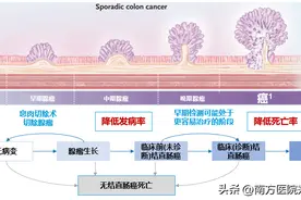 要做肠镜了，不要慌，3种清肠方法选择能帮助你泄干净图片