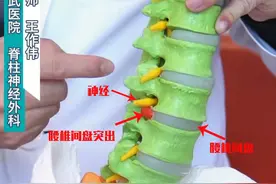 腰椎间盘突出要做手术，什么时候做微创？什么时候就要打钉子了？图片