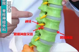 腰椎间盘突出要做手术，什么时候做微创？什么时候就要打钉子了？图片