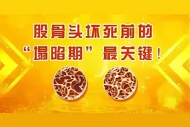 一方治疗股骨头坏死，屡试不爽！让你行走自如图片