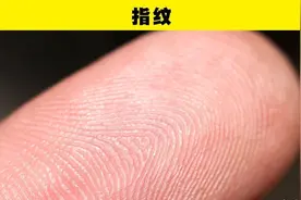 生物学冷知识：通常更有可能从父亲那里遗传的6个特征图片