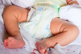 “这么热别给娃穿纸尿裤了”！夏天这样护臀才对，看完转给身边人图片