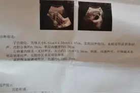 宫外孕的那件事图片