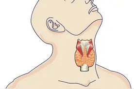 确诊甲状腺结节，遇4种情况，别犹豫，尽早处理，避免发生癌变图片