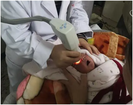 新生娃松软无力，一定做甲基化基因检测，可能是小胖威利综合征