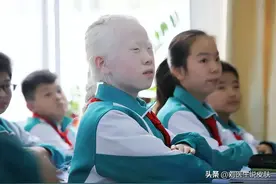 大家可以保存下来这篇文章，以便于自查自己的白斑是不是白癜风图片