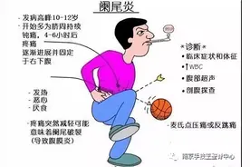“阑尾炎”是如何形成的？图片