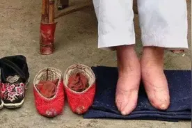 “最后一位”裹脚女性亲述：15岁靠三寸金莲嫁大户，洗脚过程煎熬图片