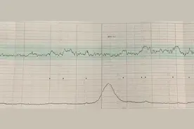 孕晚期需要做胎心监护，怎么才算正常的监护呢?图片