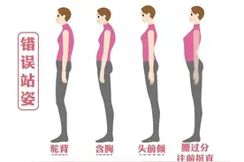 你站对了吗？错误站姿让你的脊椎面临3大风险图片