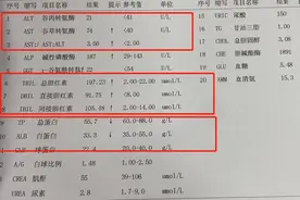 这三个指标意味着你肝功能严重受损，一次性教会你图片