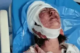 唐山打人事件背后真相曝光！越挖越心凉图片