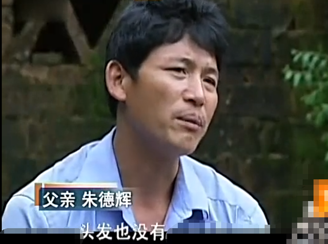 弥漫性表皮松懈角化症