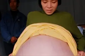 “巨腹女人”彭细妹：患癌后被离婚，她选择流浪街头，如今怎样了图片