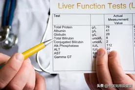 谷丙转氨酶与谷草转氨酶，哪个升高更危险？该怎样降下来？图片