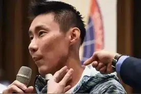 李宗伟：36岁罹癌，电疗33次花千万苦不堪言，老婆不离不弃图片