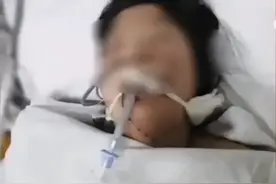 河北14岁女孩误服农药病危，已完成插管手术，捐赠医药费仅够维持一周图片