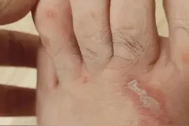 紧急！陕西已出现！最近高发！碰到千万别拍图片