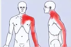 手麻，究竟是哪里的问题？不出意外，这5种可能性大图片