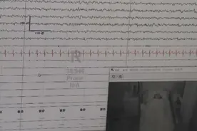 女孩基因突变最快48秒睡着 大笑就浑身无力想睡觉 医生揭秘图片