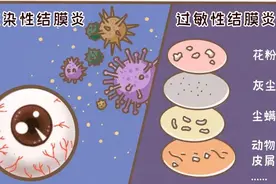 眼睛红、痒、怕光，小心是这种常见病…图片