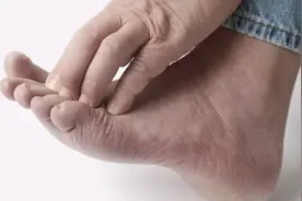 体内有病，看脚就知道？医生：脚部出现5种变化，提醒你及时检查图片
