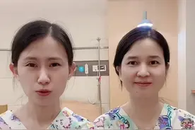 出牙期亲喂被咬怎么办，出牙期有哪些注意事项，出牙期口水疹，你家宝宝到出牙期了吗？#金牌育言家 #宝宝护理视频封面
