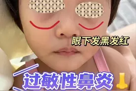 对付过敏性鼻炎，家长做好这5点，孩子改善率98%以上图片
