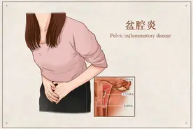 女性下腹经常隐痛、坠胀 要警惕盆腔炎图片