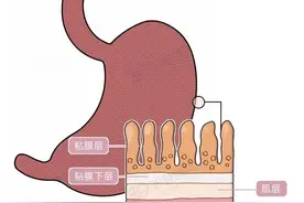 慢性胃炎的诊疗（诊断/实用总结一）图片