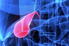 过去常用的保胆取石法，为何被踢出手术指南？胆囊切除，颇受争议图片