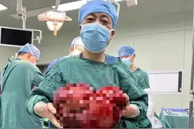 男子身患巨大肿瘤危及生命，军医紧急施救转危为安图片