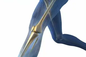 骨膜炎的症状和治疗方法图片