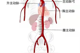 胸痛之主动脉夹层患者的处置图片
