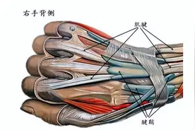 小小疼痛 大大烦恼——认识腱鞘炎图片