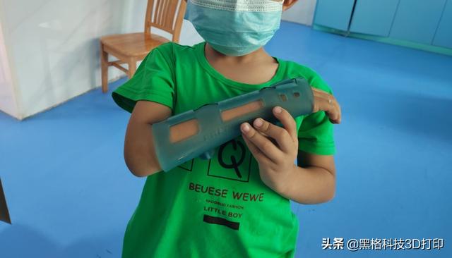 打了石膏痒怎么办