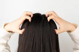 头皮出油厉害，是怎么回事？中医提醒：可能是3种疾病的信号图片