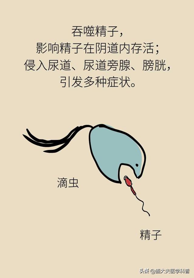 滴虫性阴道炎是很严重的妇科病吗？会不会传染？